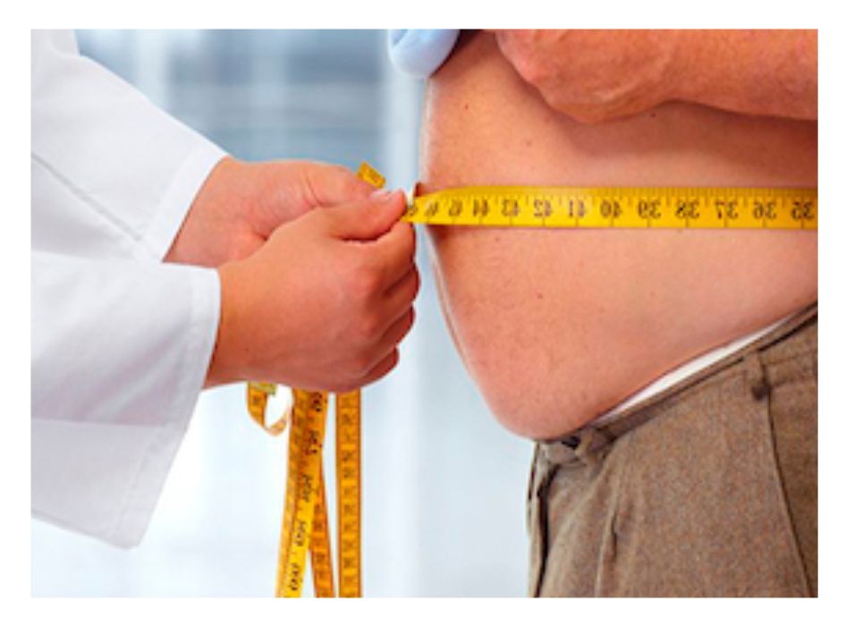 Cirugía de la Obesidad y la diabetes
